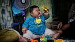 Potret Kenzie Si Bayi Viral Obesitas di Bekasi, Umur Setahun Beratnya 27 Kg