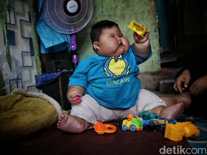 Kemenkes Pastikan Biaya Perawatan Bayi Obesitas di Bekasi Dicover BPJS