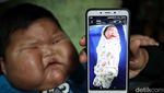 Potret Kenzie Si Bayi Viral Obesitas di Bekasi, Umur Setahun Beratnya 27 Kg