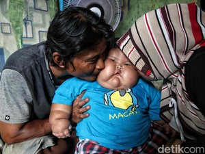 Viral Bayi Setahun Bobotnya Sampai 27 Kg di Bekasi, Ortu Buka Suara