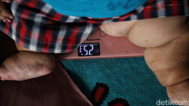 Viral bayi bernama Kenzie, punya bobot 27 kilogram di usia satu tahun. Ibunda Kenzie, Pitriah mengungkapkan berat badan anaknya memang berlebih sejak ia lahir.Akibat obesitas yang dialaminya, tumbuh kembang Kenzie terganggu. Tidak seperti bayi seusianya, Kenzie belum bisa berdiri tegak.