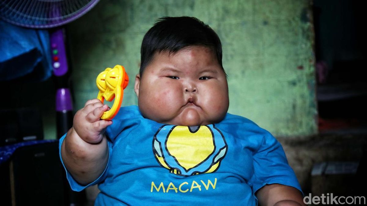 Overeenkomstig herder pion Viral Dikaitkan Bayi Obesitas Kenzie, Ahli Gizi Beberkan Bahaya Anak Diberi  SKM