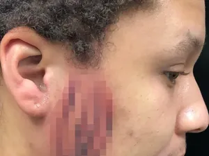 Viral Pria Nekat Tato Vagina di Wajah, Disebut Tidak Akan Dapat Kerja