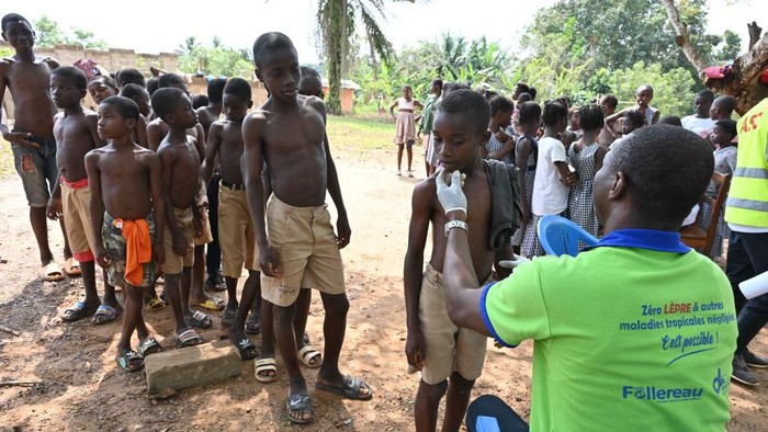 A doctor consults children during a leprosy screening campaign in village of Djougbosso, near Adzope, on January 25, 2023. - Listed by the WHO as one of the 20 neglected tropical diseases (NTDs), leprosy is transmitted from a sick person to healthy person. The microbe multiplies very slowly, and the incubation period can last up to 5 years. The first symptoms show spots, then gradually eat away at desensitized limbs. (Photo by Issouf SANOGO / AFP) (Photo by ISSOUF SANOGO/AFP via Getty Images)