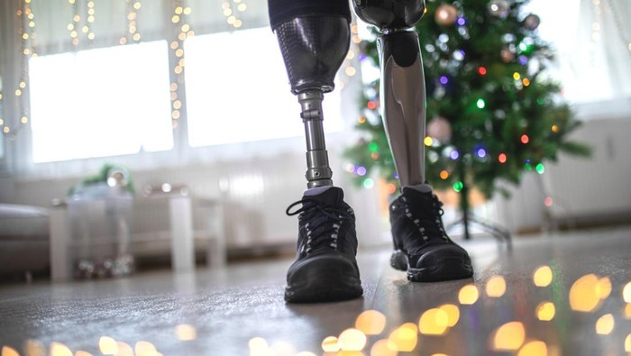 Mengenal Osteosarkoma, Kanker Tulang Langka Pemicu Utama Kecacatan Anak