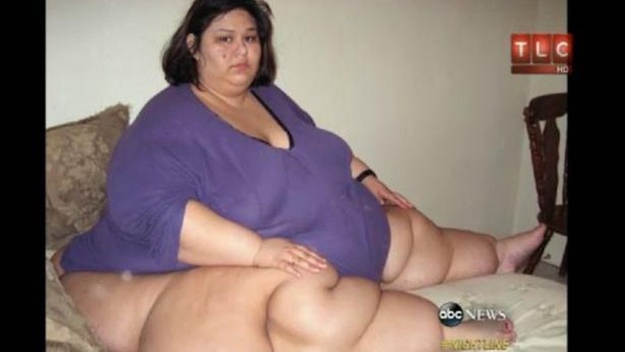 Transformasi Wanita Tergemuk di Dunia, BB Sempat 453 Kg, Berubah Total usai Diet