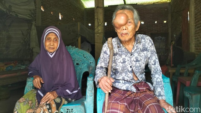 Jamaluddin lansia di Polewali Mandar, Sulawesi Barat menderita benjolan yang terus membesar di wajahnya.