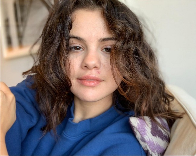 Dalam salah satu foto, tampak ada jerawat kemerahan di bawah hidungnya. Foto: Instagram/@selenagomez