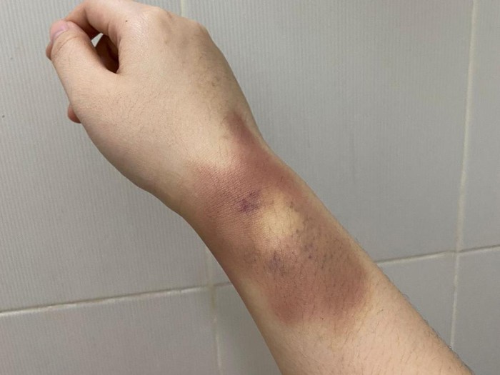 Keponakan Hotman Paris jadi korban KDRT