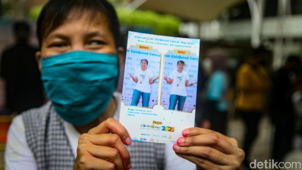 Ramai-ramai #BeraniGundul Rayakan Hari Kanker Anak Sedunia