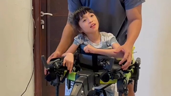 Pengasuh Anak Jevier Justin Aniaya Putrinya yang Idap Cerebral Atrophy