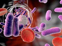 Jepang Waspadai Lonjakan Kasus Infeksi Bakteri Strep A