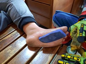 Kaki Bocah Nempel ke Sandal gegara Lem Korea, Damkar Turun Tangan