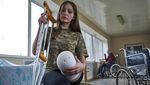 Potret Tentara Wanita Ukraina Kehilangan Satu Kaki Saat Lawan Rusia