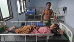 Temuan Kebocoran Ginjal Pada Anak Orang Rimba