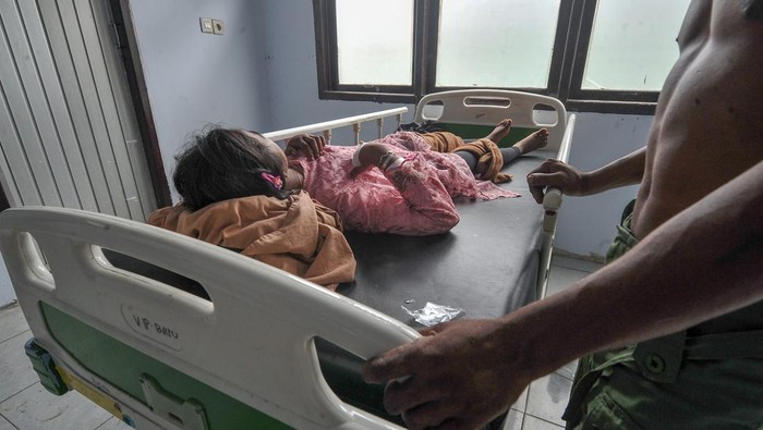 Temuan Kebocoran Ginjal Pada Anak Orang Rimba Seorang anak Orang Rimba dari kelompok Temenggung Minan Anik (15) beristirahat didampingi kerabatnya saat menjalani perawatan di RSUD Kolonel Abundjani, Merangin, Jambi, Selasa (28/2/2023). Anak Orang Rimba yang biasa hidup menumpang dan berpindah bersama kelompoknya di areal perkebunan kelapa sawit daerah itu terpaksa dilarikan ke rumah sakit setempat karena menderita kebocoran ginjal. ANTARA FOTO/Wahdi Septiawan/rwa.