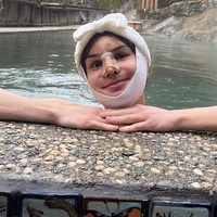 Transgender wanita 26 tahun itu telah menjalani operasi feminisasi wajah pada awal tahun ini. Di mana bagian tulang wajahnya dipotong agar menghasilkan karakter muka yang lebih lembut. Foto: Instagram/@dylanmulvaney