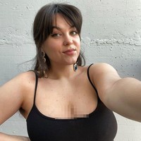 Bagaimana nasib Fenella Fox sekarang? Wanita tersebut diketahui masih cukup sering mengunggah konten di media sosial. Kesehatannya pun bisa dibilang tidak terlalu parah. Tapi karena tidak kunjung hilang, ia berjanji untuk suatu hari benar-benar meninggalkan ponsel ketika tidak dibutuhkan. Aku tidak bisa melakukanya lagi. Aku tidak bisa melakukannya sendiri. Aku kadang mencoba memakainya selama yang dulu tapi aku sakit lagi, kata Fenelle.    Foto: Instagram Fenelle Fox