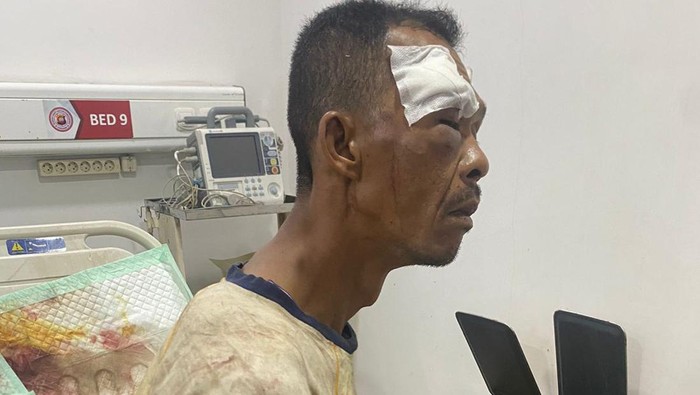 Pria berinisial RH (44) di Kota Pontianak, Kalimantan Barat (Kalbar) babak belur diamuk massa karena kepergok hendak mencuri motor.