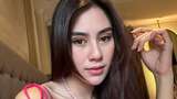 Kata Nisya Ahmad soal Syahnaz Sadiqah Disebut Oplas oleh Netizen