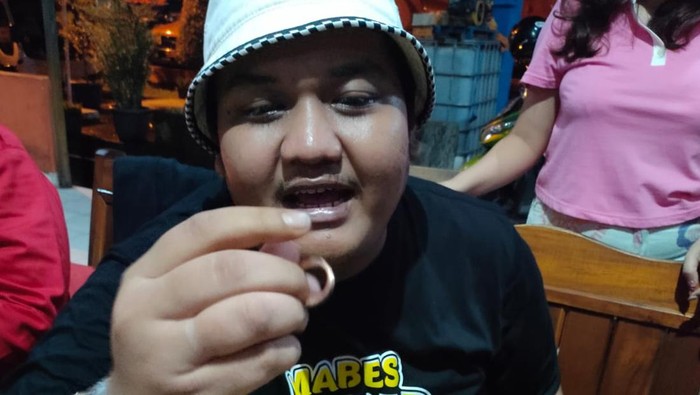 Petugas saat melakukan pelepasan cincin di jari manis Ndarboy Genk yang tidak bisa dilepas selama seminggu.