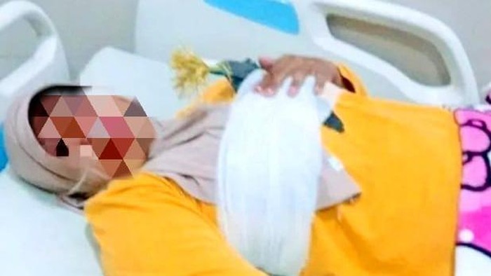 Wanita pengendara motor di Gowa terbaring lemas usai payudaranya terkena tembakan busur di jalanan.
