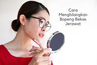 10 Cara Menghilangkan Bekas Jerawat Yang Menghitam