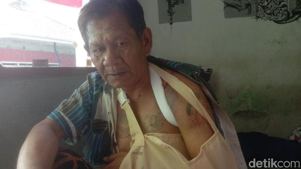 warga kota malang tertimpa papan reklame