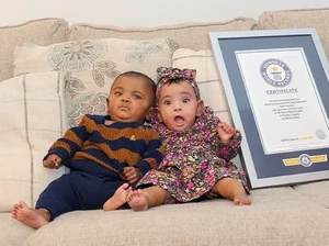 Bayi Kembar Ini Dinobatkan Paling Prematur di Dunia, Lahir di Usia 22 Minggu