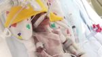 8 Foto Bayi Kembar Paling Prematur di dunia, Rayakan Ulang Tahun yang Pertama
