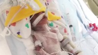 Saat bayi kembar itu lahir, dokter sempat memberikan penanganan beberapa komplikasi yang dialami oleh bayi tersebut, termasuk perdarahan otak dan sepsis. Keduanya dipulangkan dari rumah sakit setelah dirawat selama enam bulan. (Foto: Guinness World Records).