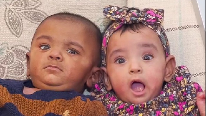 Bayi kembar paling prematur di dunia Bayi kembar paling prematur di dunia