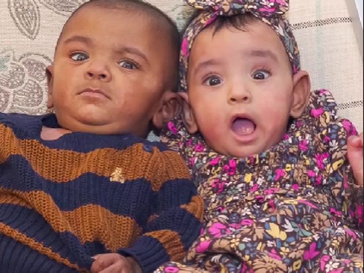 8 Foto Bayi Kembar Paling Prematur di dunia, Rayakan Ulang Tahun yang Pertama