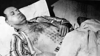Pada tanggal 20 Mei 1967, Stefan Michalak berada di hutan dekat Danau Falcon, Manitoba, Kanada ketika dia melihat dua UFO berbentuk cerutu mendarat di dekatnya. Ketika sebuah pintu terbuka, Michalak mendengar suara-suara, lalu mencoba berkomunikasi dengan makhluk di dalamnya. Dia mendekati pintu pesawat itu, tetapi tidak bisa melihat apa pun di dalamnya kecuali apa yang dia gambarkan sebagai labirin cahaya. Tiba-tiba pintu pesawat tertutup, dan benda itu mulai naik dan mengeluarkan semacam udara panas ke Michalak melalui ventilasi seperti kisi-kisi yang menyebabkan bajunya terbakar. Dokter dibuat bingung dengan pola luka bakar di seluruh dada Michalak. Foto: Reddit