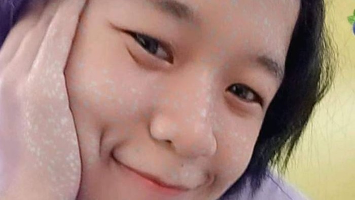 Gadis ABG asal Sleman, Putri Bernadetha (17) dilaporkan hilang keluarganya. Foto diunggah Rabu (8/3/2023).