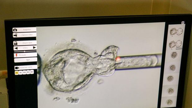 Biopsi Embrio. (Dok Morula IVF)