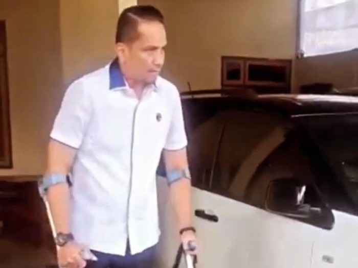 Dirreskrimum Polda Jambi, Kombes Andri Ananta Yudhistira menggunakan tongkat saat masuk kantor