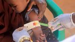Miris! Pengungsi Somalia Kelaparan hingga Dehidrasi Imbas Kekeringan
