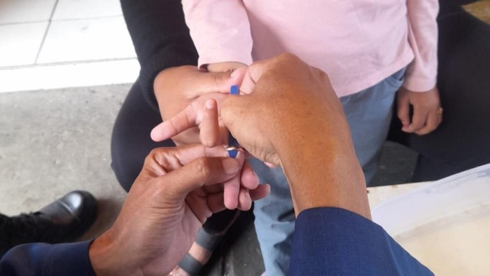 Petugas Damkar Ciamis mengevakuasi cincin yang terjebak di jari bocah berusia 5 tahun.