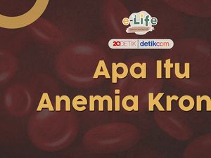 Wanita Lebih Rentan Terkena Anemia