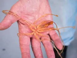 Hewan Menyeramkan Penghuni Laut Dalam, Bikin Merinding