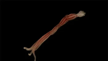 Cacing zombie (Osedax) umumnya ditemukan di sisa-sisa paus yang membusuk di dasar laut, menggali ke dalam tulang mereka untuk mendapatkan makanan di dalamnya. Tanpa mulut, usus, atau anus yang berfungsi, mereka memiliki bakteri yang mencerna sisa-sisa yang mengerikan bagi mereka. Foto: Themindcircle