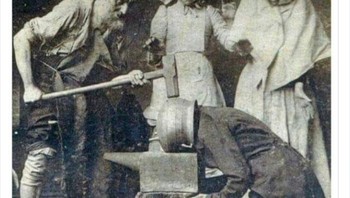 Pengobatan sakit kepala di tahun 1895. Kok ngeri ya, lihatnya?  Foto: LIHpios via Bored Panda