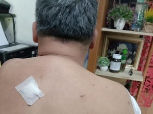 Dibegal di Bogor, Pengurus PSI Jabar Terkena 10 Sabetan Celurit