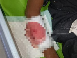 7 Fakta Insiden Berdarah Bocah SD di Blitar Dibacok Teman Saat Main Bola
