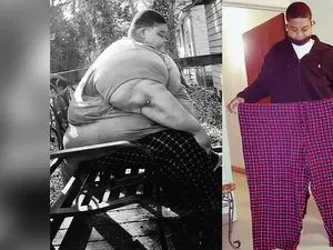 Terapkan Pola Makan Defisit Kalori, Pria Ini Berhasil Turun BB 165 Kg