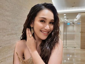 Transformasi Ayu Ting Ting Setelah Tanam Benang di Hidung, Begini Jadinya