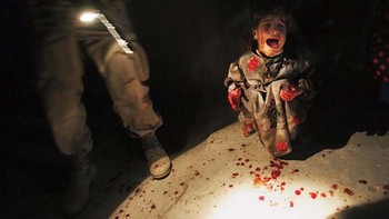 Beberapa saat sebelum jurnalis foto Amerika Chris Hondros mengambil foto Samar Hassan ini, gadis kecil itu berada di kursi belakang mobil keluarganya saat mereka pulang dari kota Irak, Tall Afar. Sekarang Samar adalah seorang yatim piatu, orang tuanya ditembak mati oleh tentara AS yang melepaskan tembakan karena khawatir mobil itu mungkin membawa pemberontak atau pelaku bom bunuh diri. Saat itu Januari 2005, dan perang di Irak paling brutal. Foto: Rarehistoricalphotos