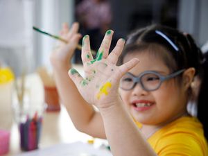 Penyebab Down Syndrome pada Anak, Ciri, Risiko, dan Cara Mencegahnya