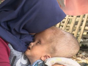 Kisah Sedih Anak Pekerja Serabutan Alami Hidrosefalus, Mari Kita Bantu